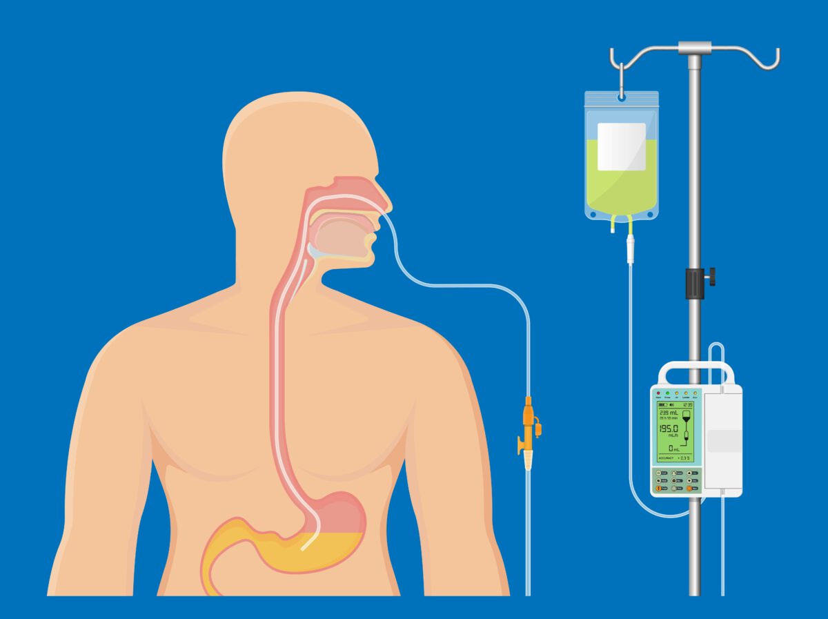 parenterale-und-enterale-ern-hrung-emma-pflegedienst